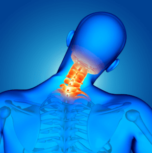 Chiropractor for Neck Pain